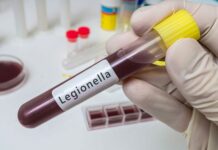 Choroba legionistów: jak przed nią się bronić?